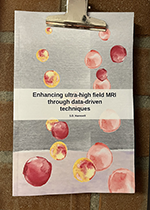 Enhancing ultra-high field MRI through data-driven techniques ISBN: 9789038660714 - Title: Enhancing ultra-high field MRI through data-driven techniques